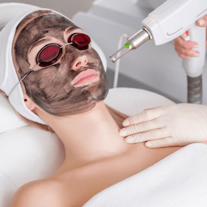 carbon facial toning