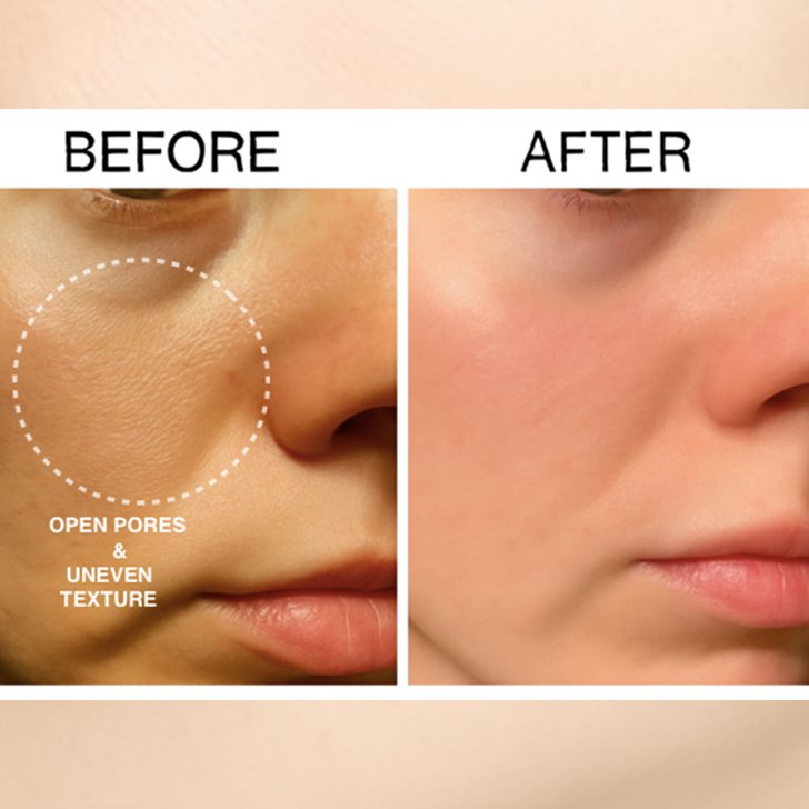 open pores