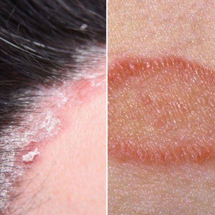 longstanding skin and hair diseases