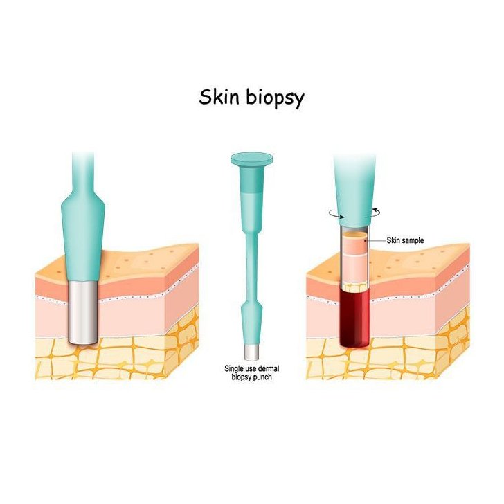 skin biopsy